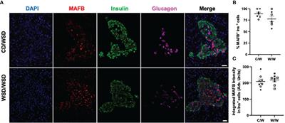 Analysis of beta-cell maturity and mitochondrial morphology in juvenile non-human primates exposed to maternal Western-style diet during development
